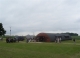 nissen external